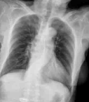 CASIA-CXR