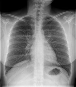 CASIA-CXR