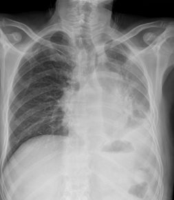 CASIA-CXR