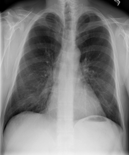 CASIA-CXR