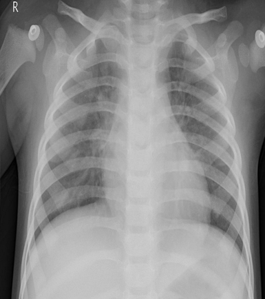 CASIA-CXR