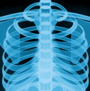 CASIA-CXR: An Open Chest X-ray Dataset with Benchmarks for Automatic Radiology Report Generation in French